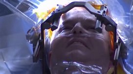 Reuters: в Neuralink знали о недостатках вживленного в мозг пациента чипа