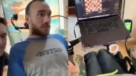 Компания Маска ищет второго добровольца для вживления мозгового импланта