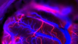 Маск сообщил, что второму человеку успешно вживили в мозг имплант Neuralink