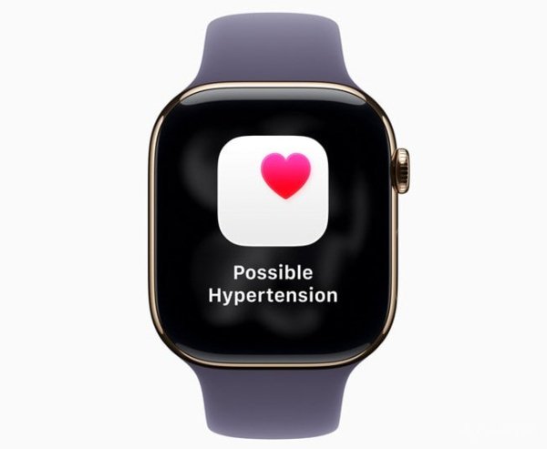 Apple выпустила watchOS 26: дизайн Liquid Glass, новые функции Apple Intelligence и мониторинг гипертонии (8 фото) Apple выпустила watchOS 26: дизайн Liquid Glass, новые функции Apple Intelligence и мониторинг гипертонии (8 фото)