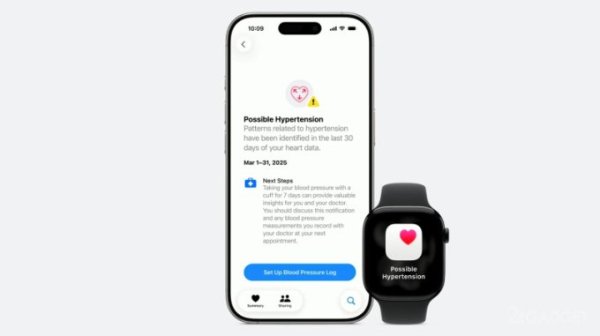 Apple представила смарт-часы Watch Series 11 — самые тонкие, с 5G и детектором гипертонии за $399 (5 фото)